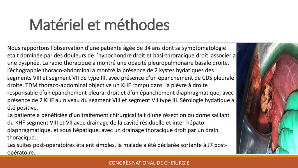 Kyste hydatique rompu dans la plèvre à propos dun cas ppt télécharger